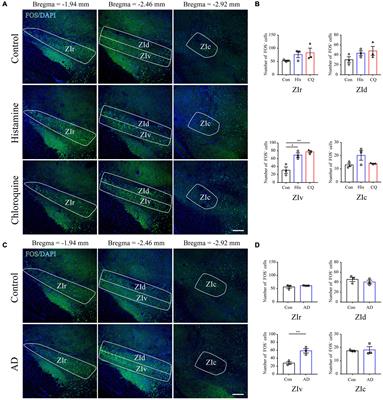 Parvalbumin Neurons in Zona Incerta Regulate Itch in Mice